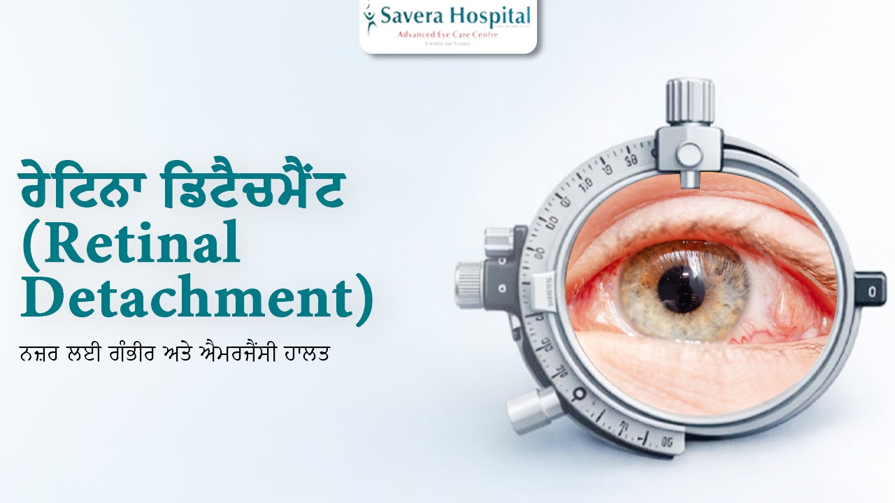 Retinal Detachment Surgery