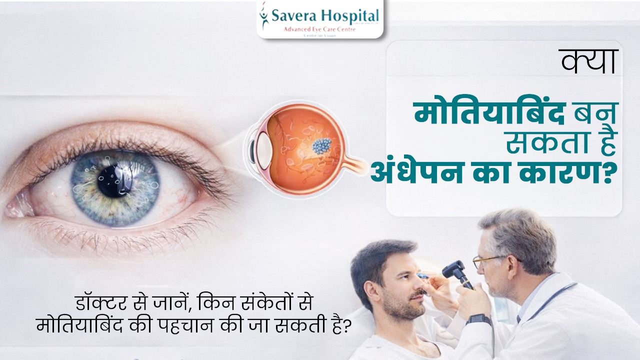 Cataract